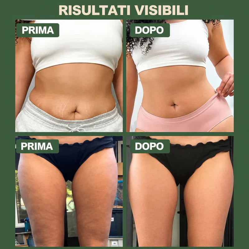 Coppettazione Vacuum Anticellulite